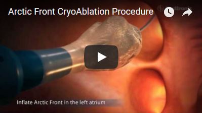ARctic Front CryoAblation.JPG